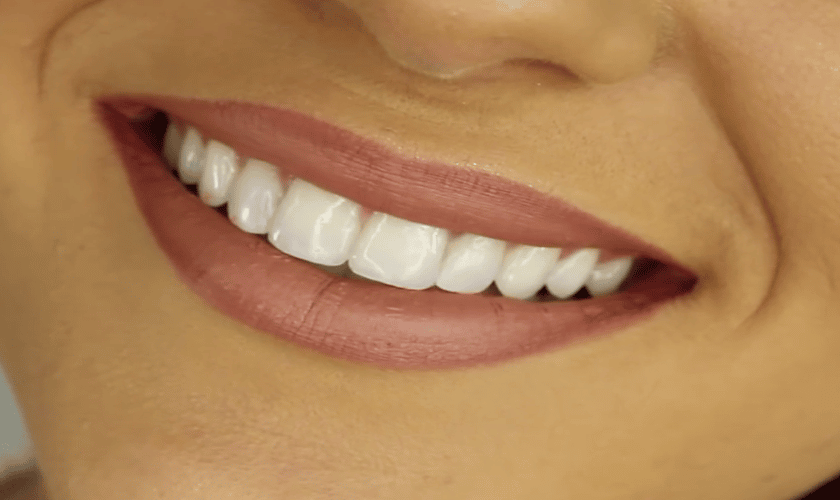 Teeth whitening at home