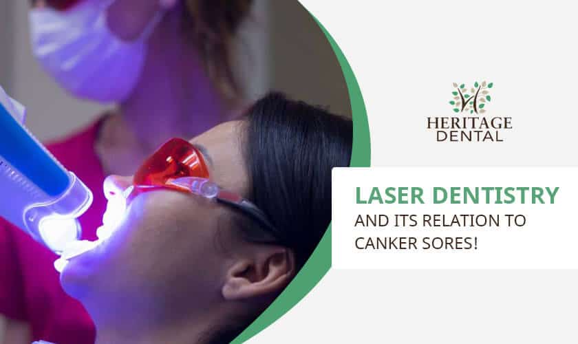 Laser Dentistry relation with canker sores