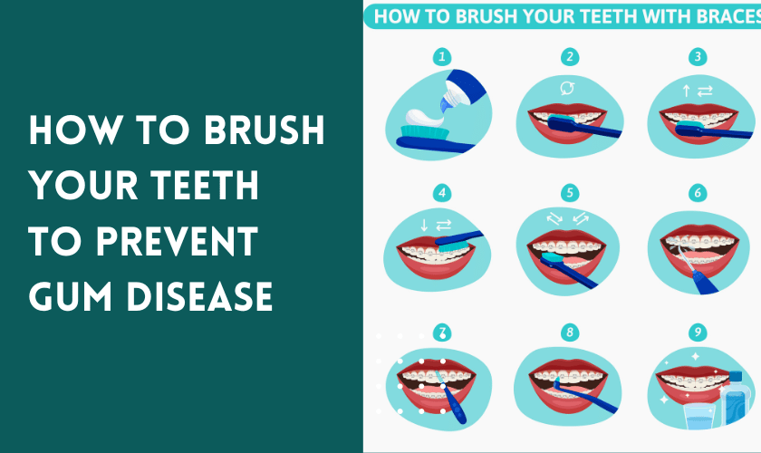 Brush Your Teeth to Prevent Gum Disease
