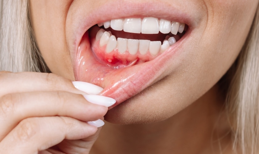 best antibiotic for gum infection