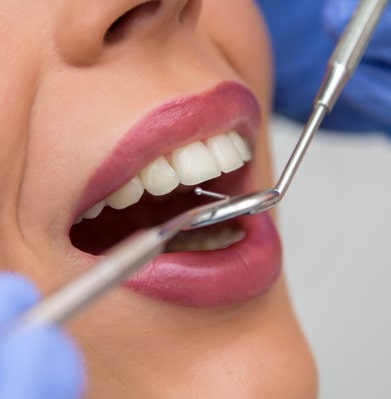 pre-thanksgiving dental care tips for a bright smile