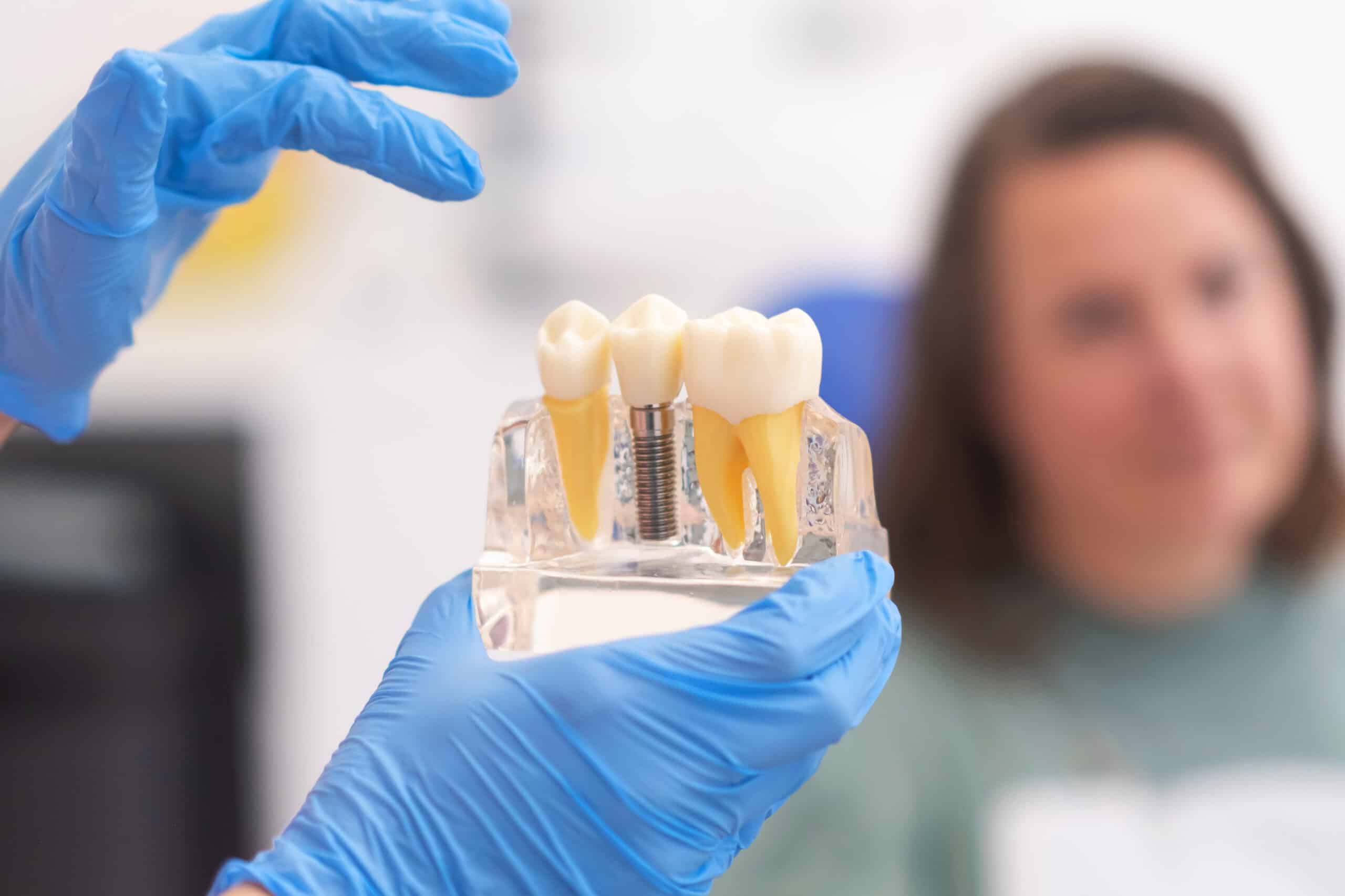 Dental Implants in