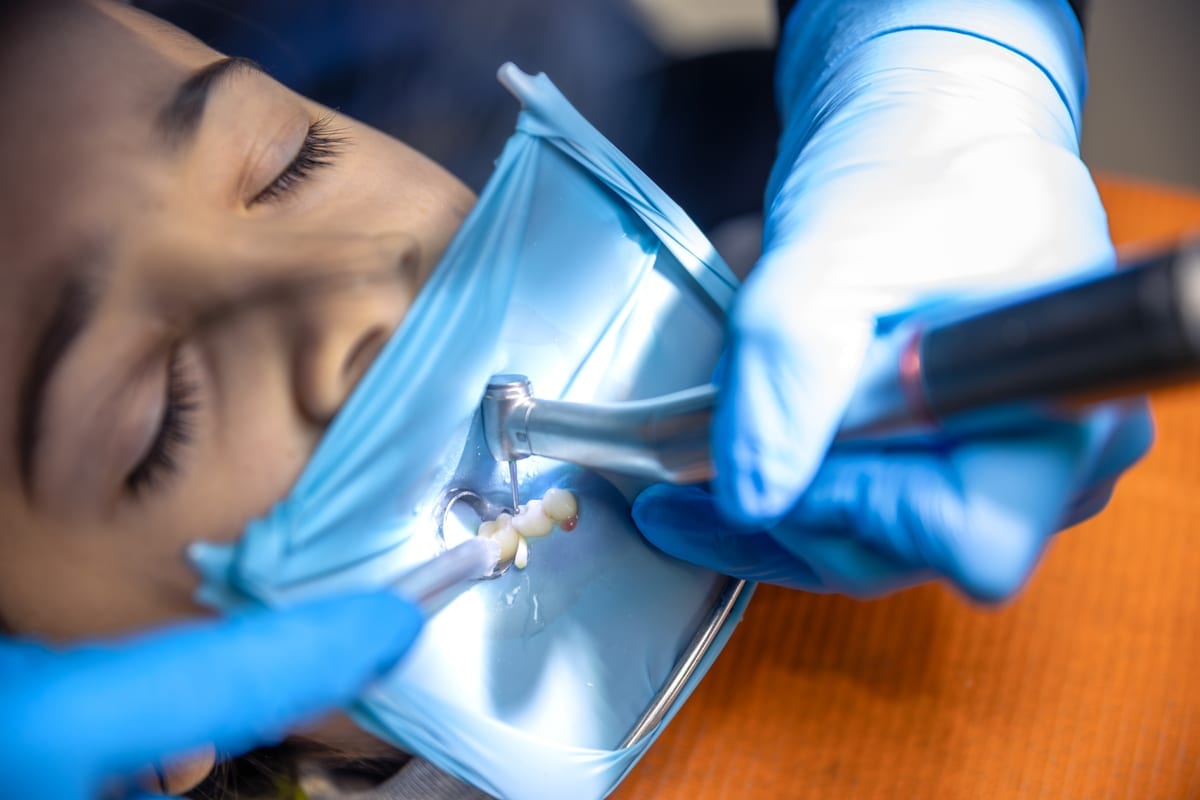 Root Canal Treatment in Katy